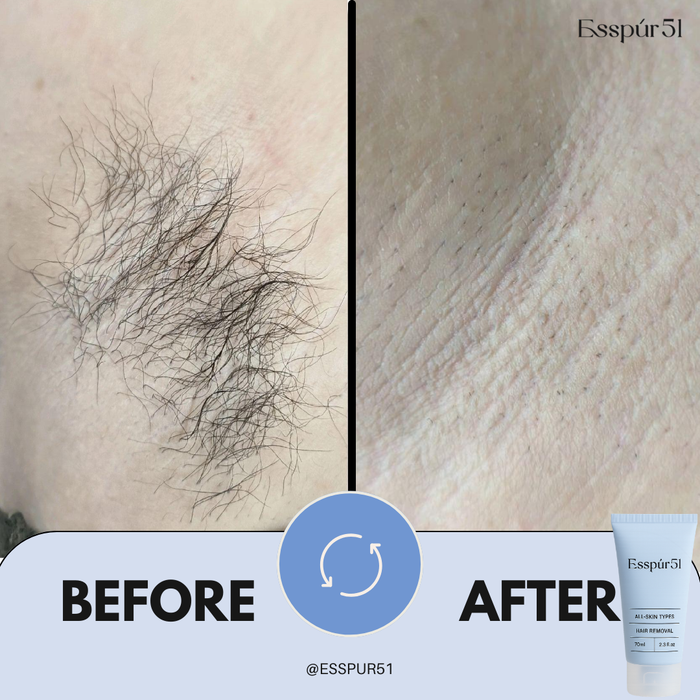 SET B - Hair Removal Cream x2 + Free Aloe Vera x1